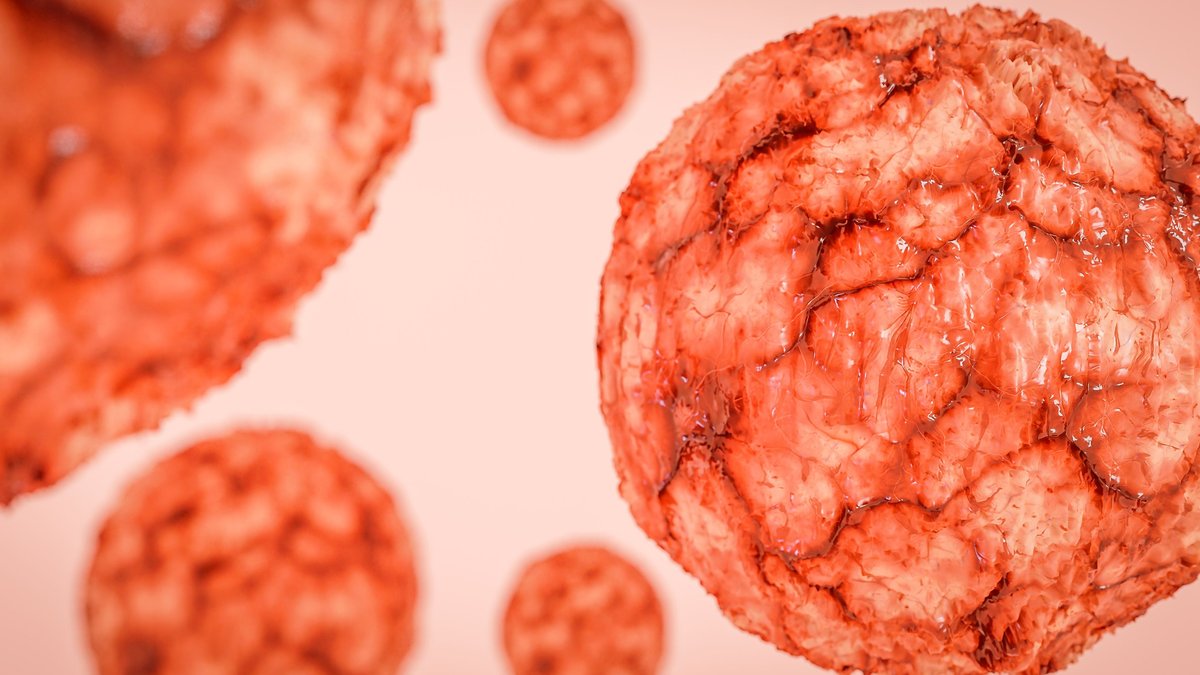 New Treatment Boosts Lymphoma Patient Outcomes - lymphoma treatment