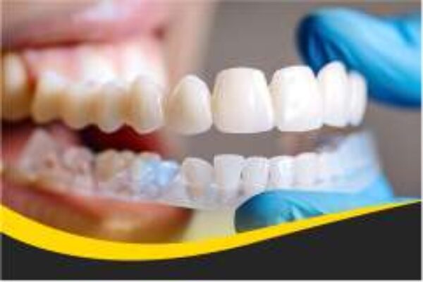 Understanding the Role of a General Dentist in Your Oral Health
