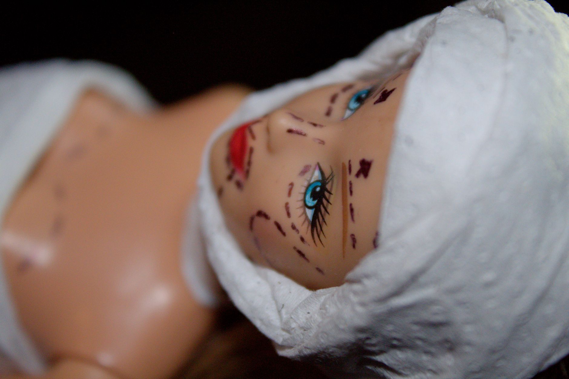 How To Make An Informed Decision About Plastic Surgery