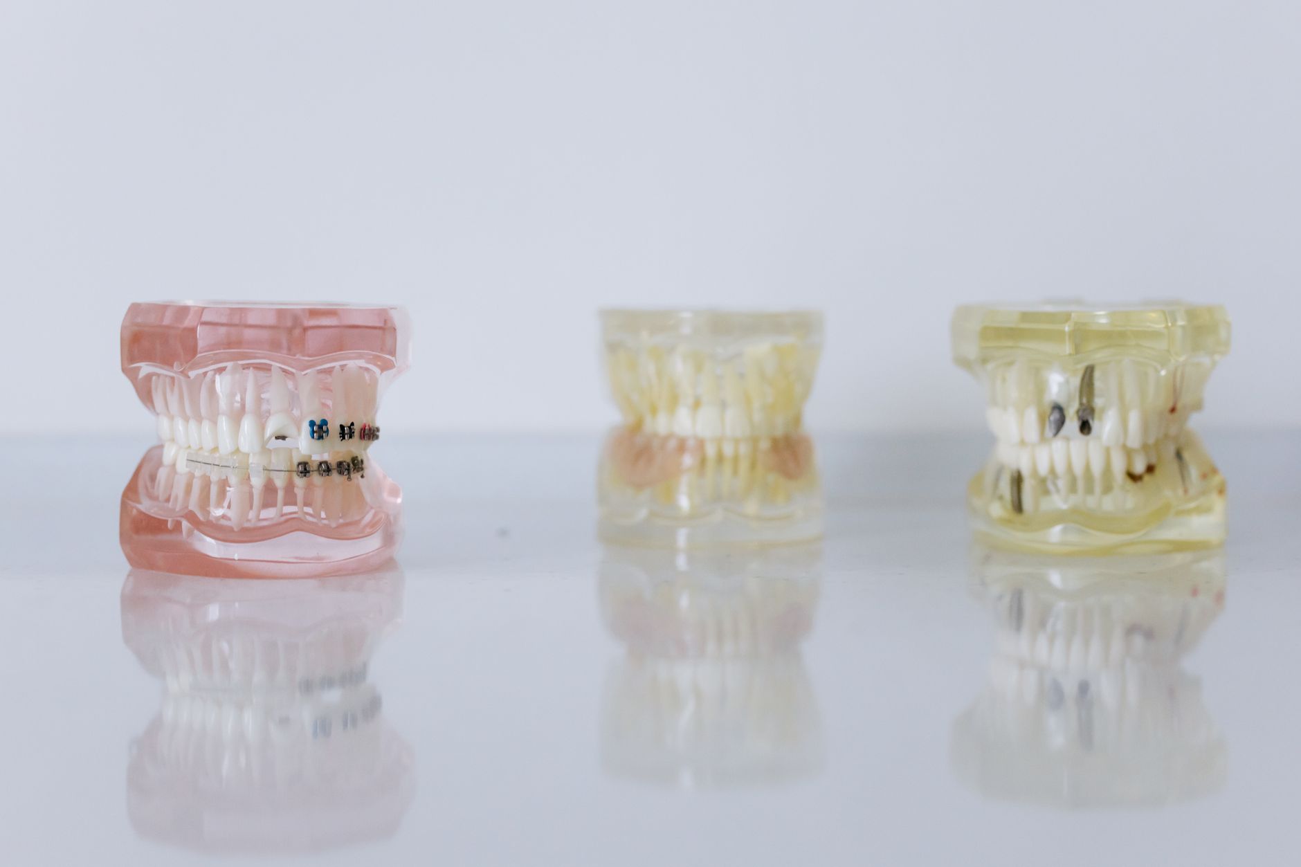 Choosing the Right Cleanser for Dental Appliances