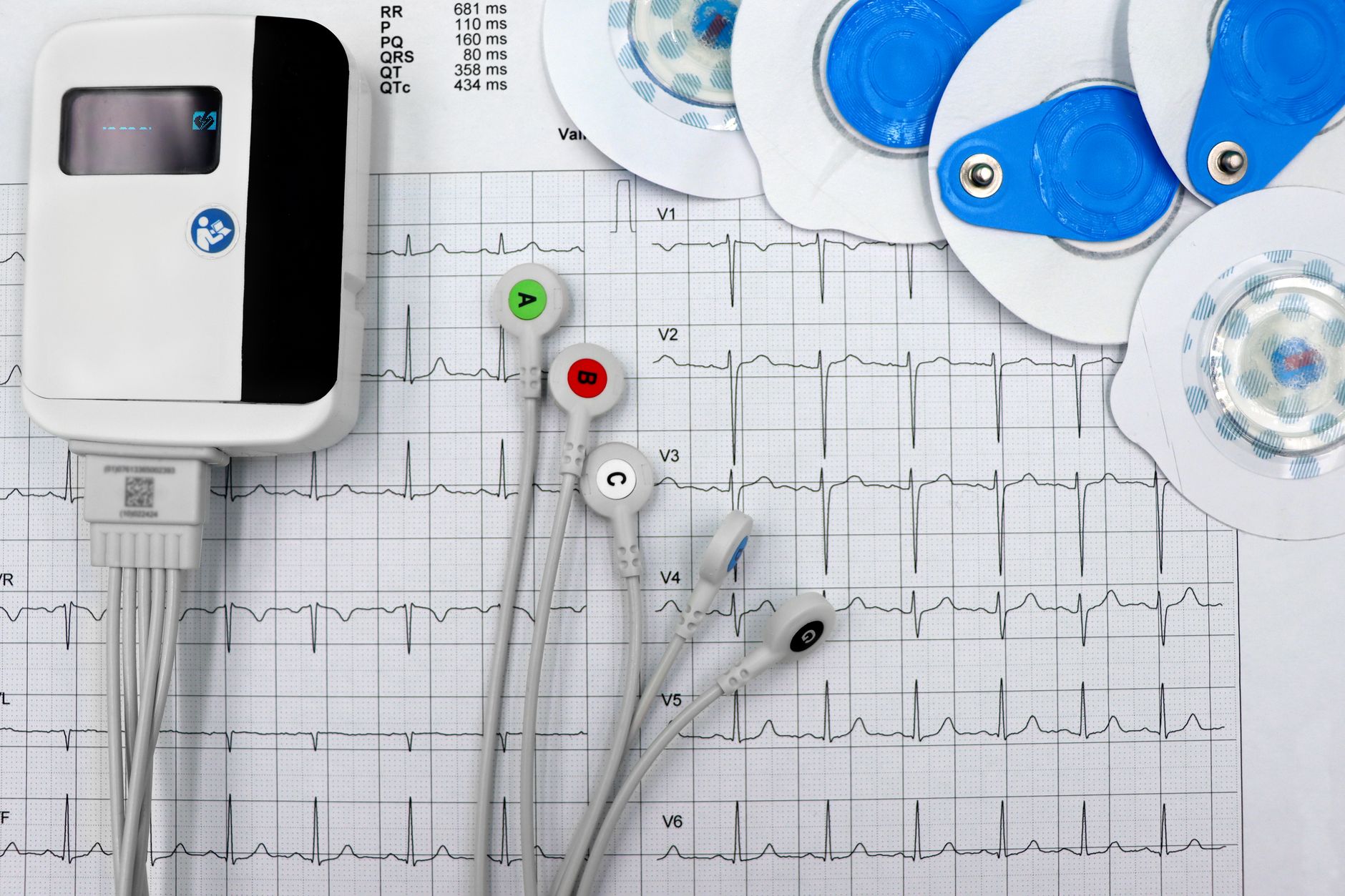 Everything You Should Know About Atrial Fibrillation