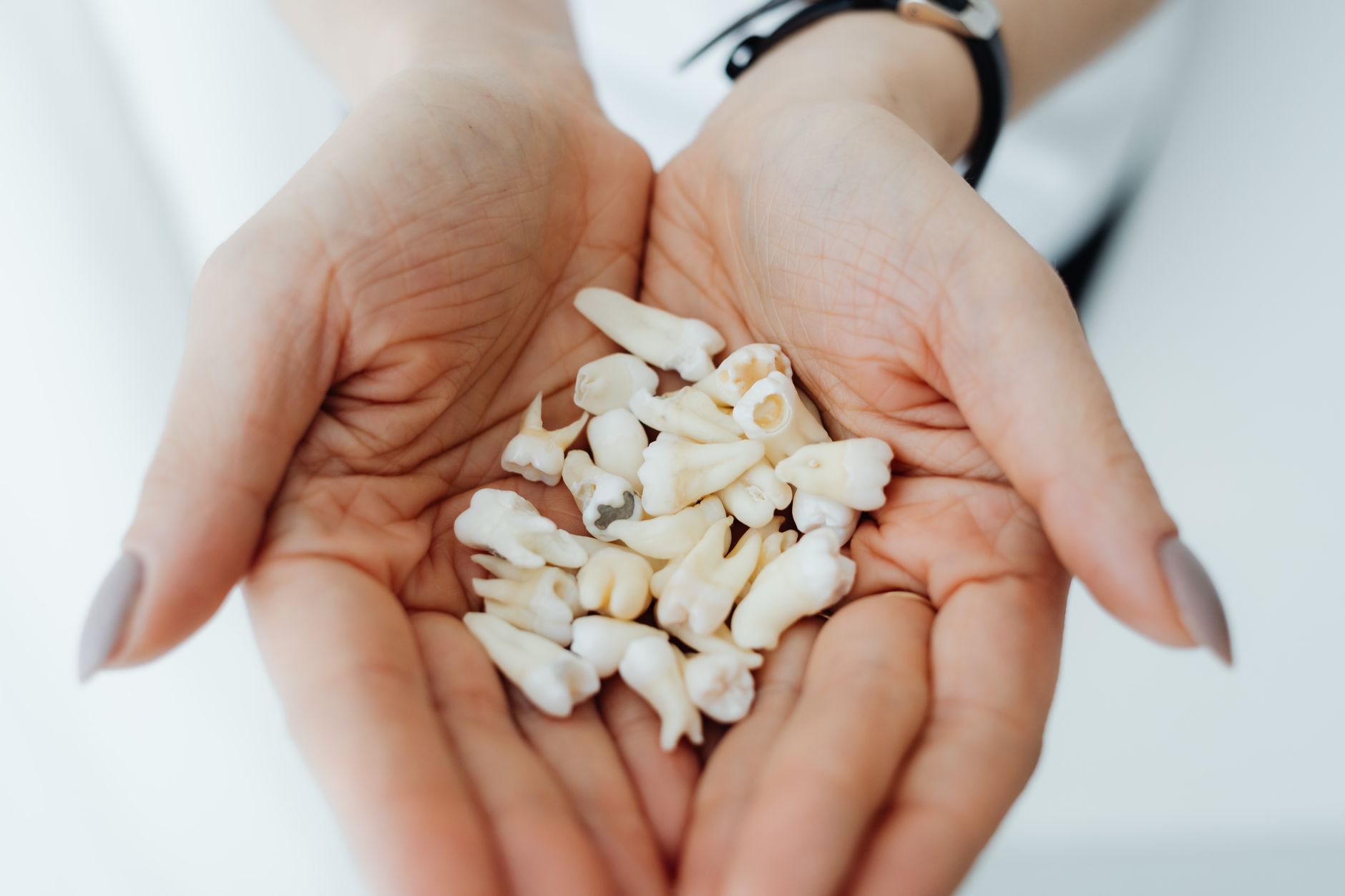 How Long Does It Take to Recover from Wisdom Tooth Removal?