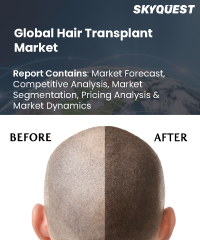 Global Hair Transplant Market