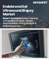 Global Endobronchial Ultrasound Biopsy Market