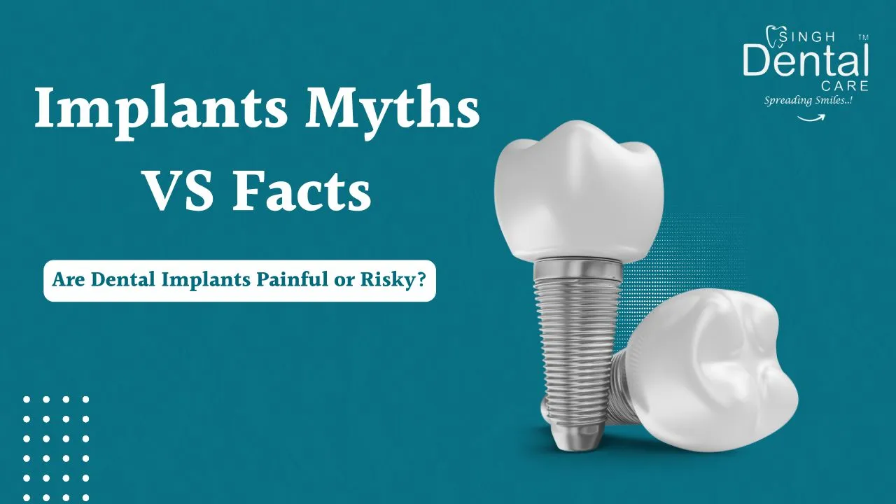 Are Dental Implants Painful or Risky? Myths vs Facts Explained