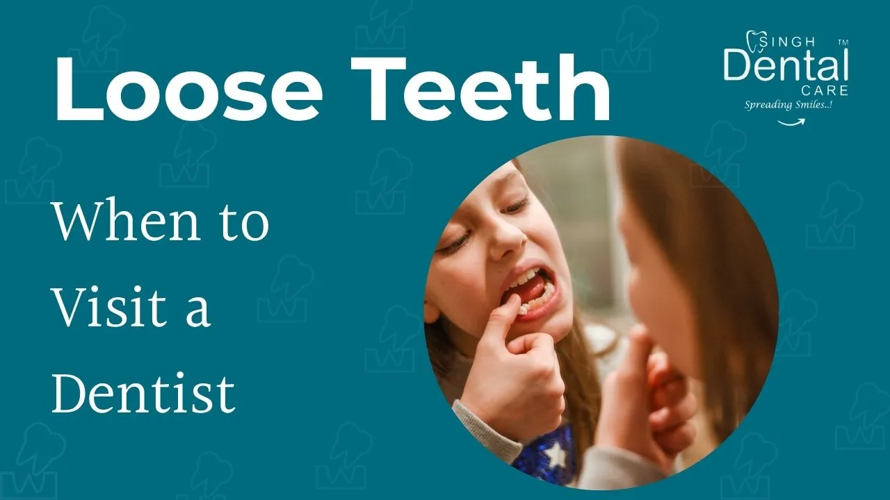 Loose Tooth in Adults? Here's When It's a Dental Emergency