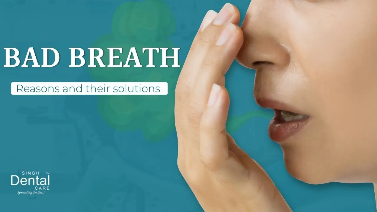 Bad Breath (Halitosis): Dental Causes and Effective Solutions | Singh Dental Care