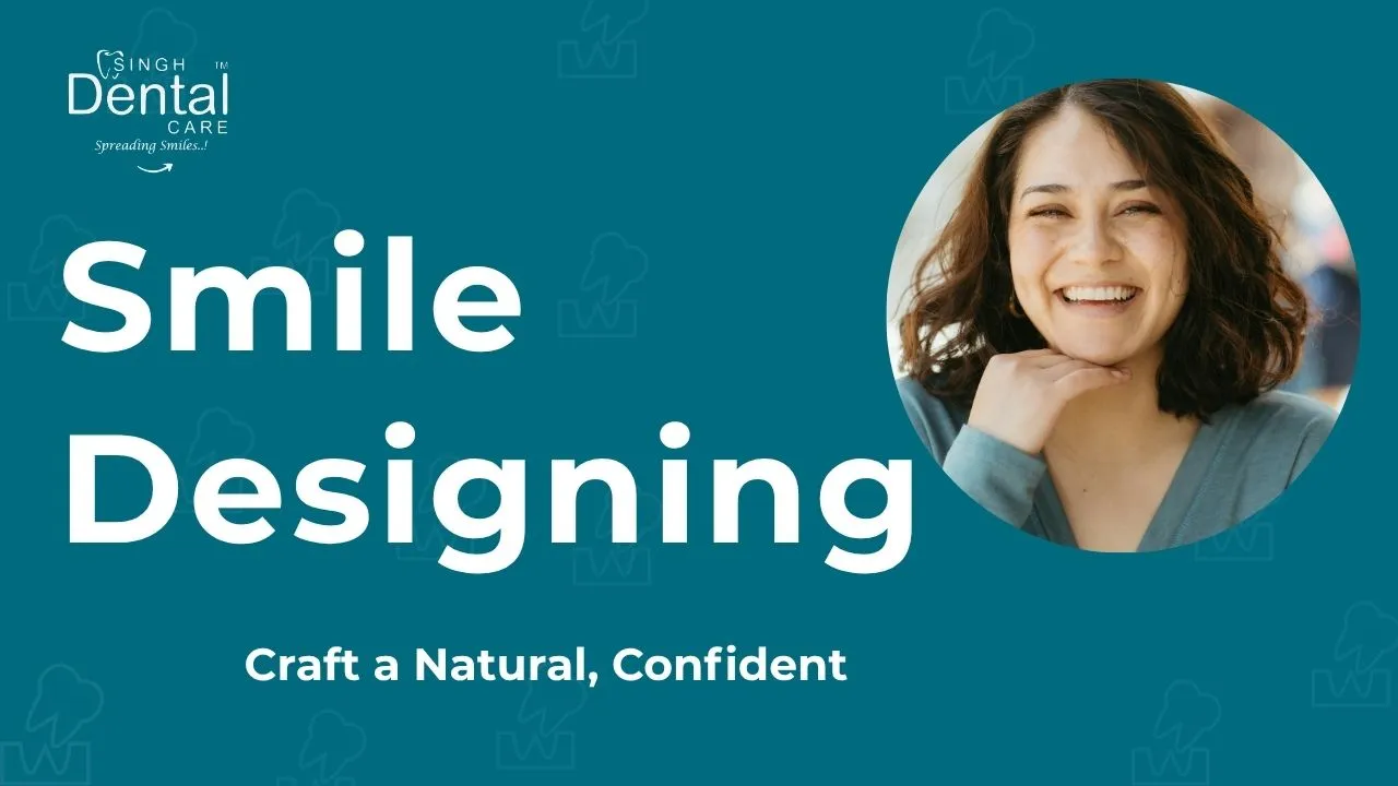 Smile Designing: Craft a Natural, Confident Smile at Singh Dental Care
