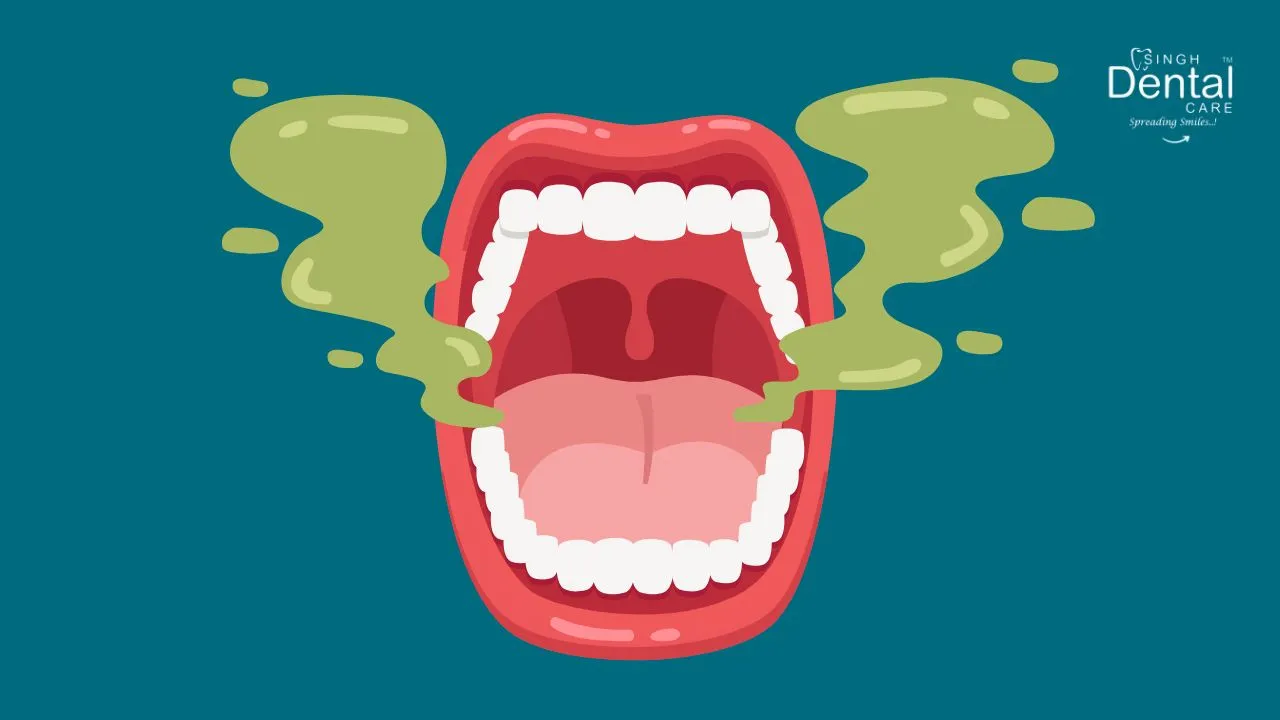 Bad breath