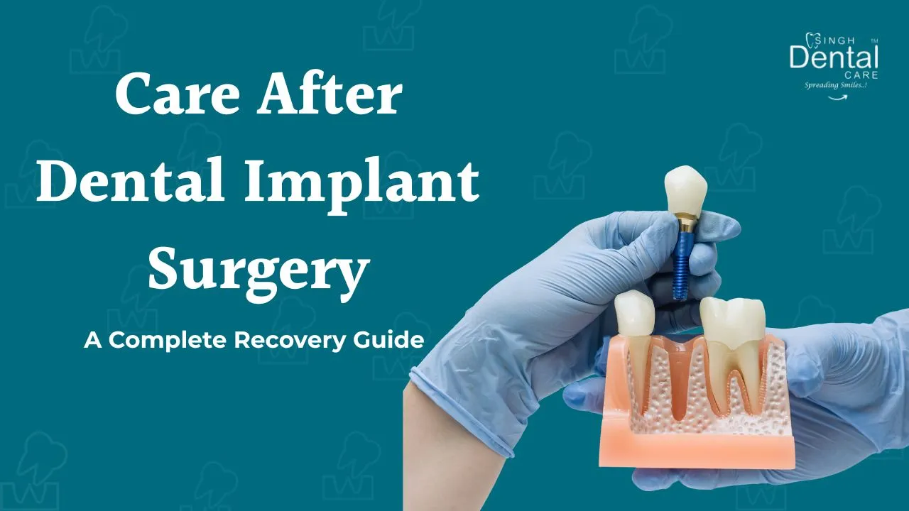 Post-Operative Care After Dental Implant Surgery: A Complete Recovery Guide