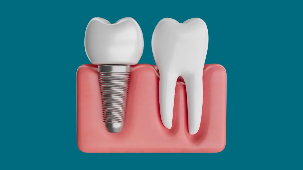 implant