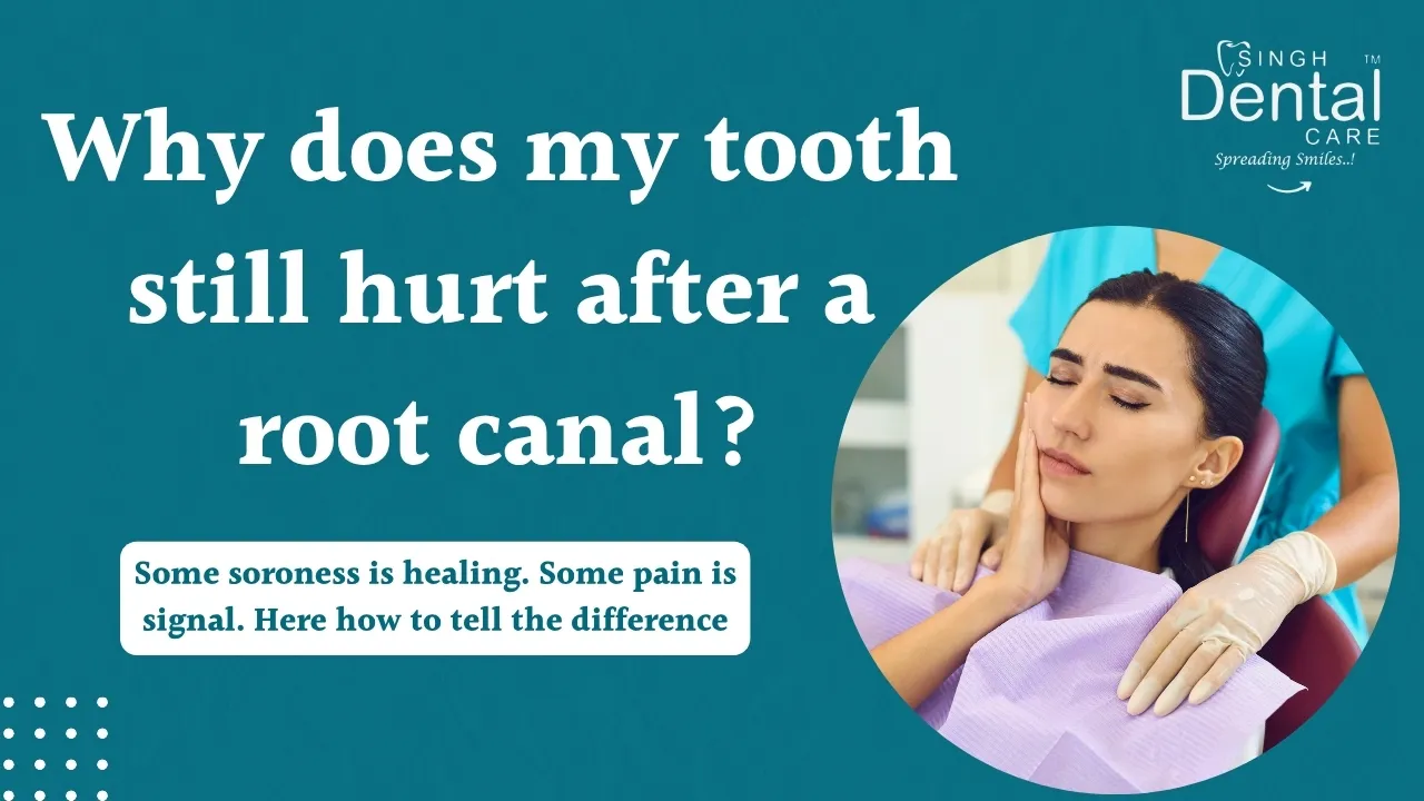 Tooth Pain After RCT