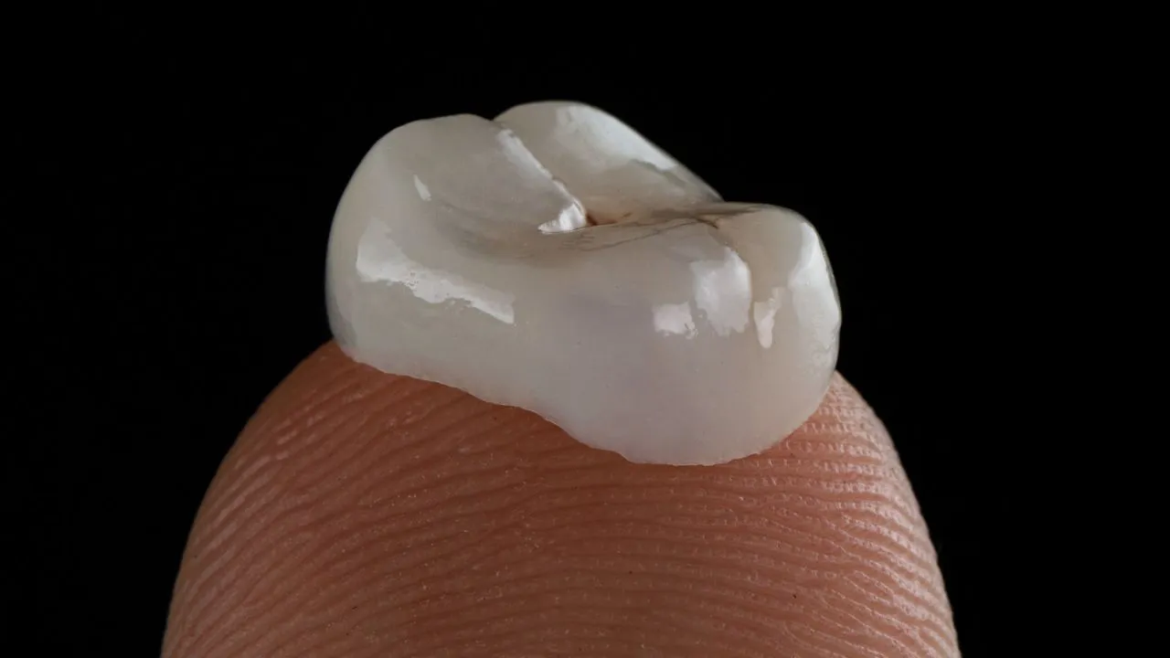Dental crowns