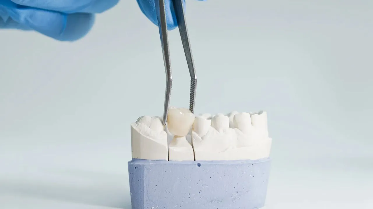 dental crown