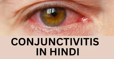 Conjunctivitis