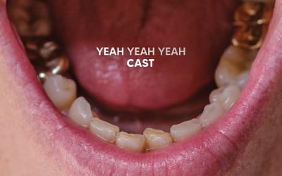 Cast - Yeah Yeah Yeah (Scruff of the Neck)