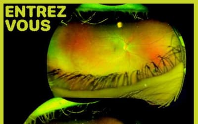 Entrez Vous Returns with ‘Tell Her A Joke’ EP: The Perfectly Imperfect Fusion of Lo-Fi Aesthetics and jangly Indie Sounds!