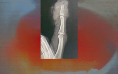 Single: Catcase – A Ring