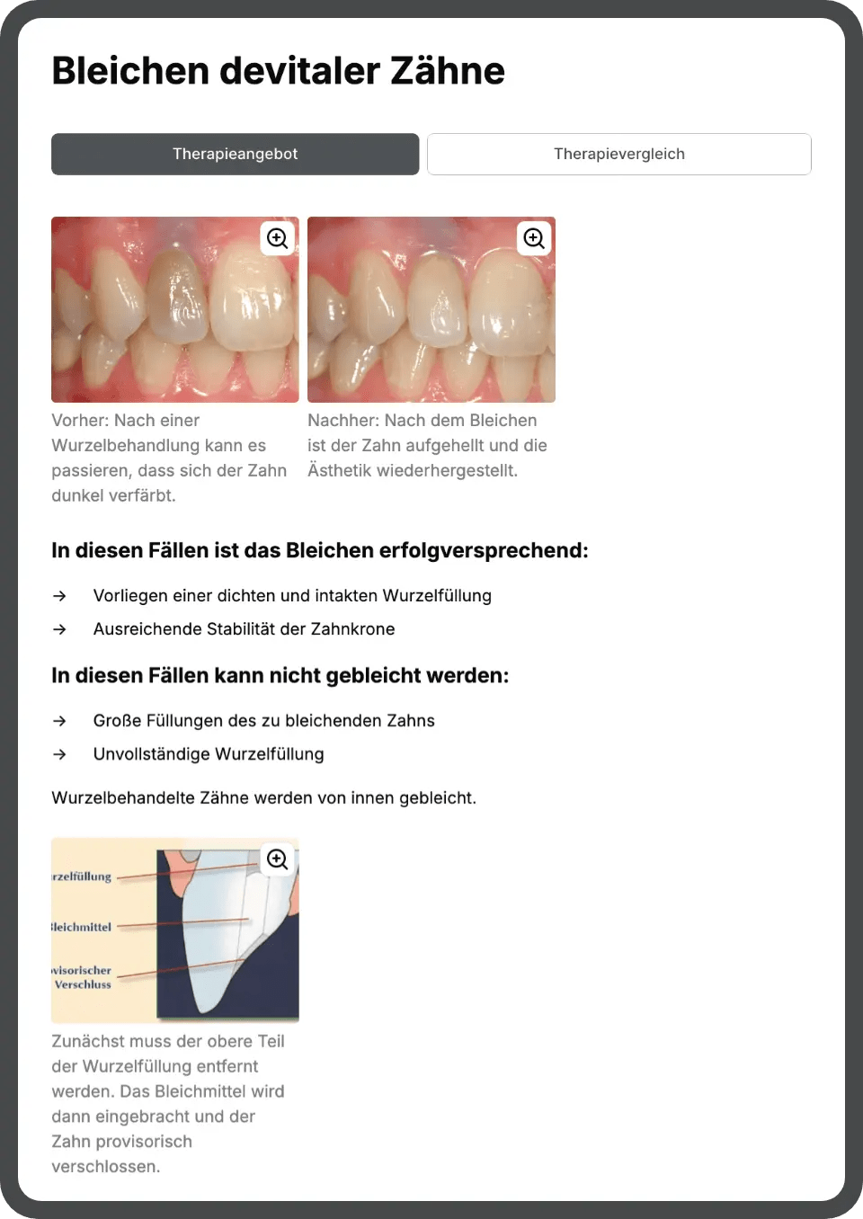 Vergleichsübersicht mit Vor- und Nachteilen