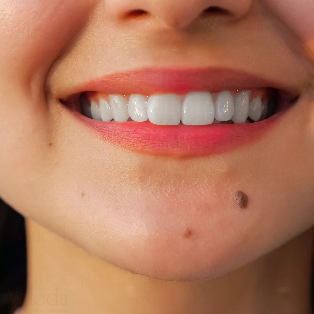 Moles