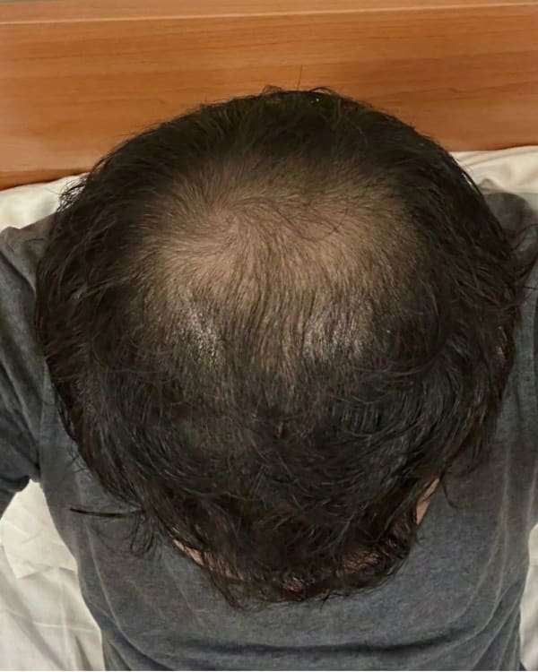 Before treatment