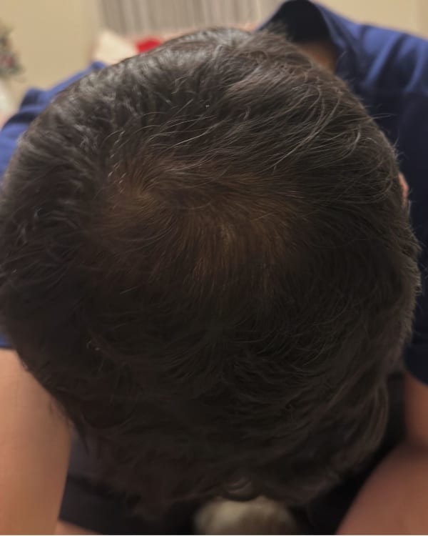 After treatment