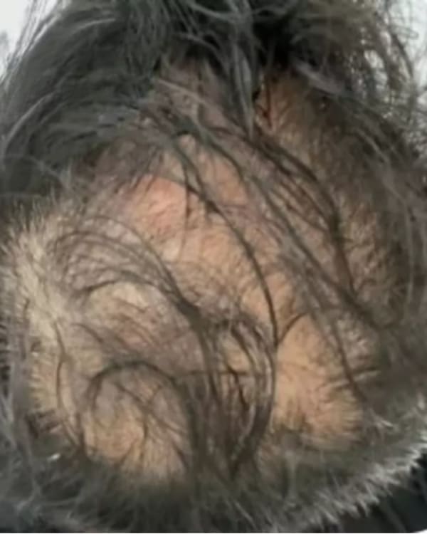 Before treatment