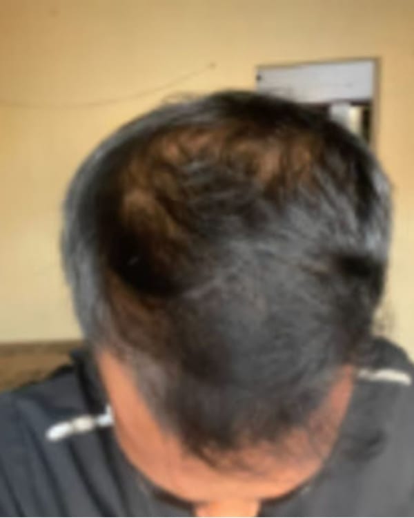 Before treatment