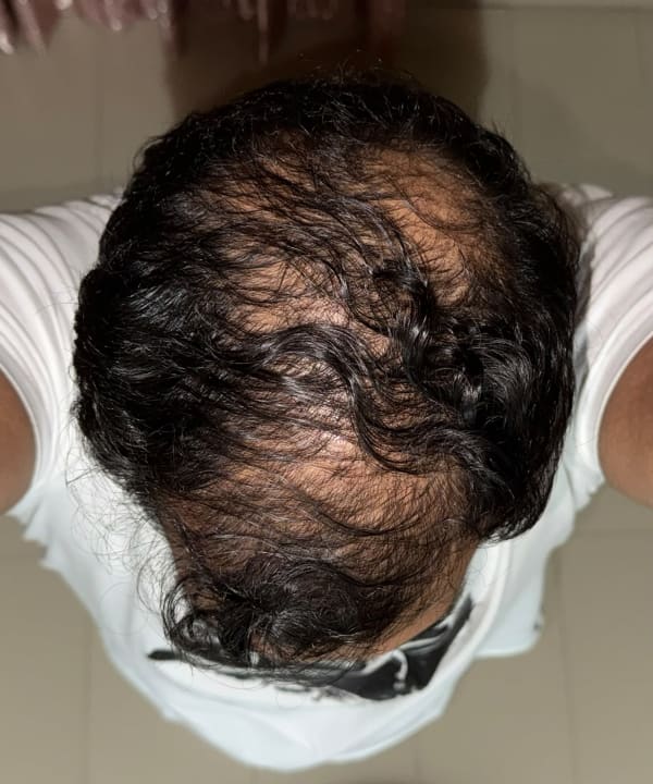 Before treatment