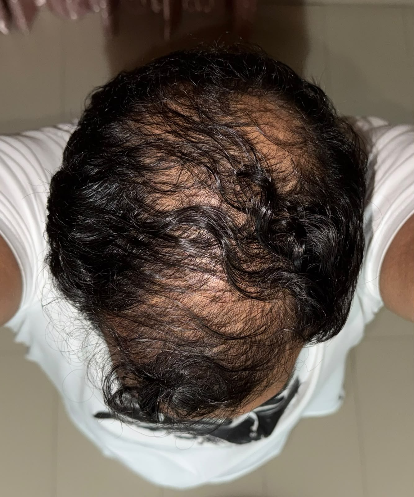 Before treatment