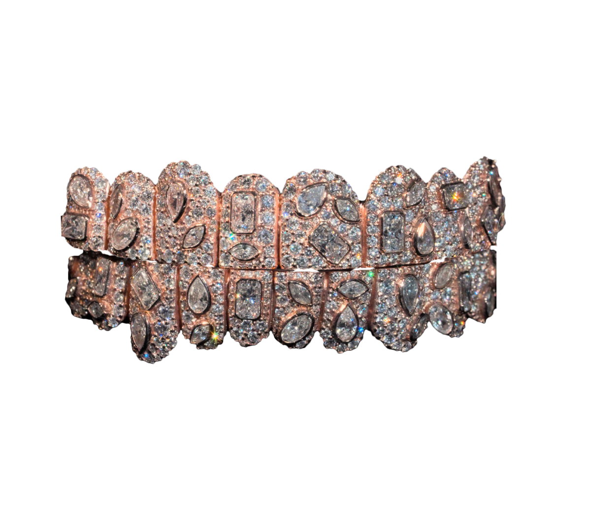 Moon Rock Set grillz