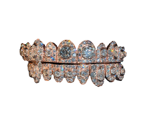 Honeymoon Set grillz