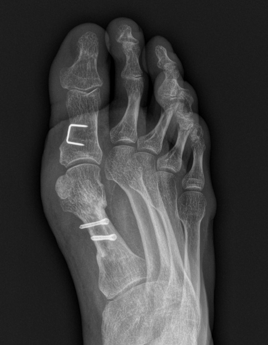 Surgery and unfavorable recovery process