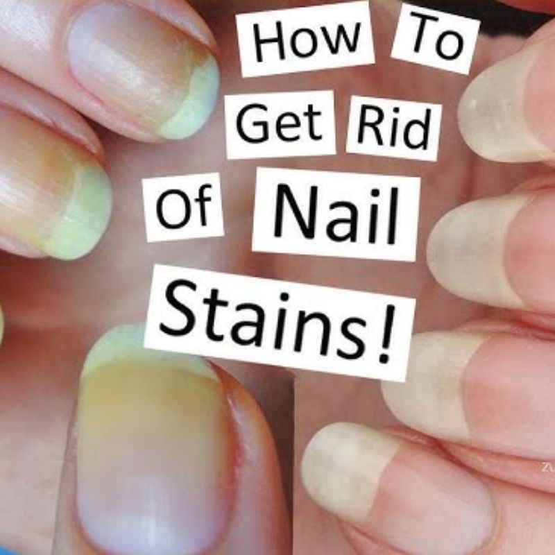 removing yellow stains from white nail polish using baking soda and lemon juice natural whitening method tutorial