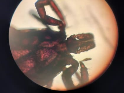 440 горожан пострадали от укусов клещей. Зафиксировано 4 случая заболевания энцефалитом и 14 — боррелиозом