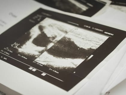 Свердловчанам дали инструкцию, куда обращаться при затруднении дыхания из-за дыма