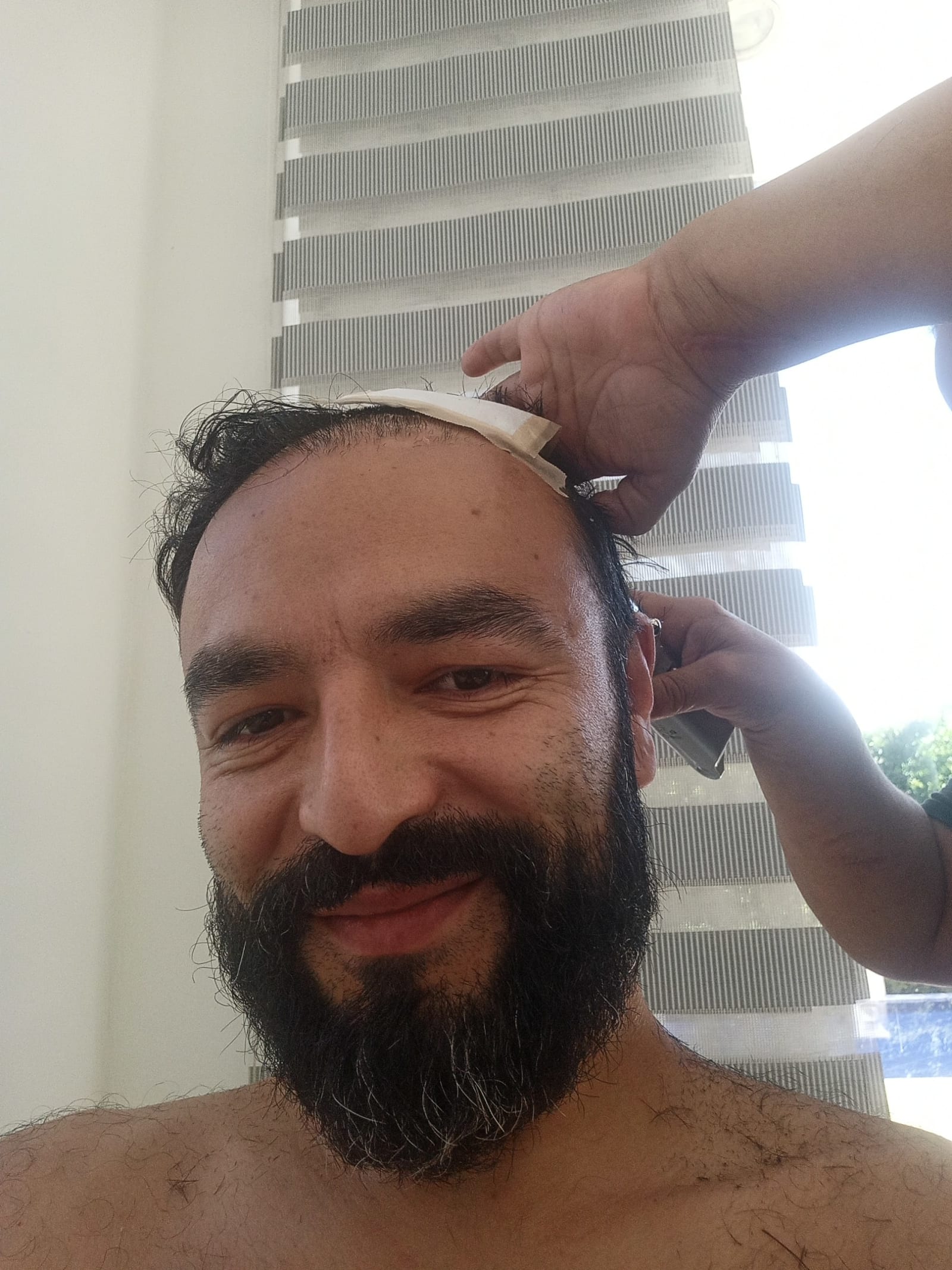 De vuelta en casa, con el corte de la cirugía.