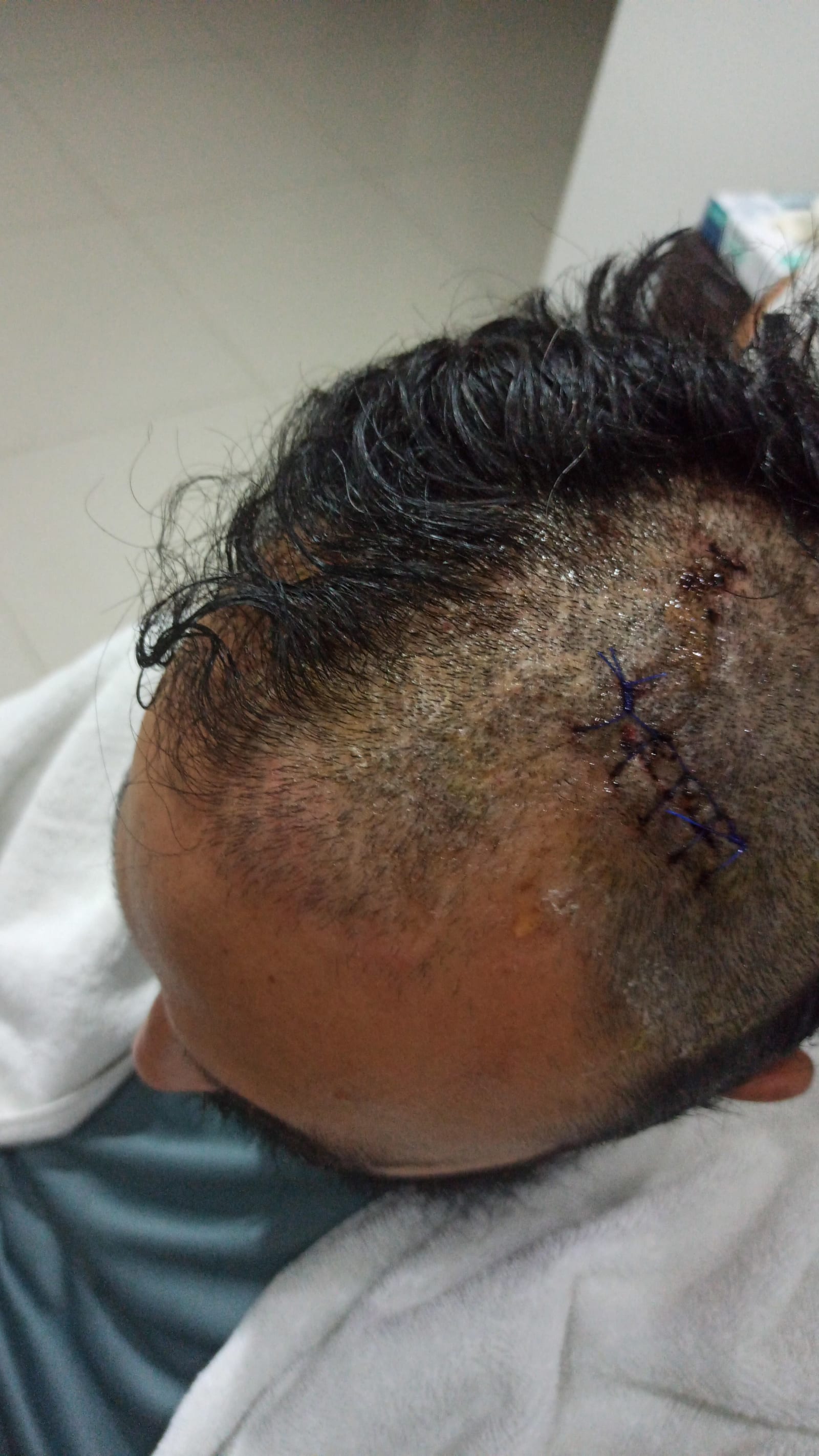 La misma cicatriz desde otro ángulo.