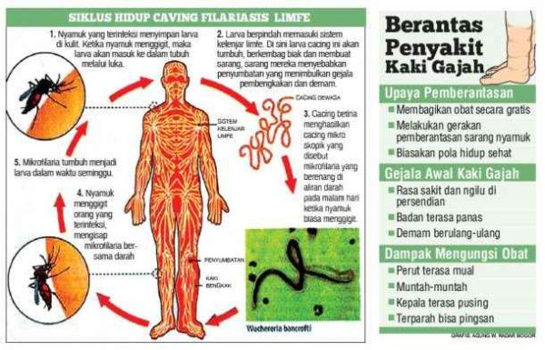 Seberapa Penting Pengobatan Massal Penyakit Kaki Gajah Depok Pos