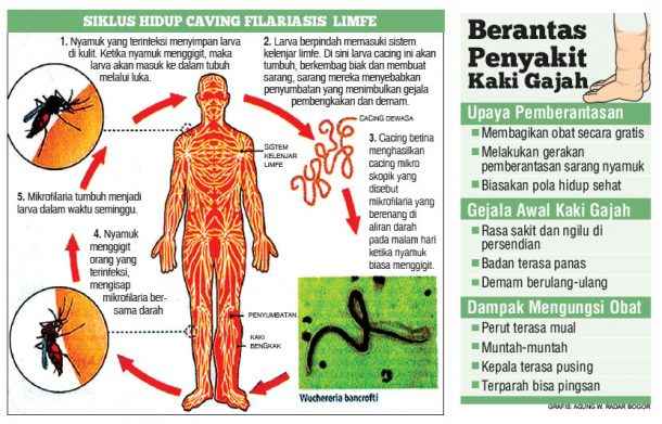 Seberapa Penting Pengobatan Massal Penyakit  Kaki  Gajah  