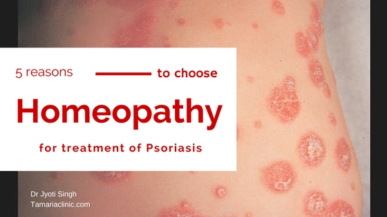 5 REASONS TO CHOOSE HOMEOPATHY FOR PSORIASIS