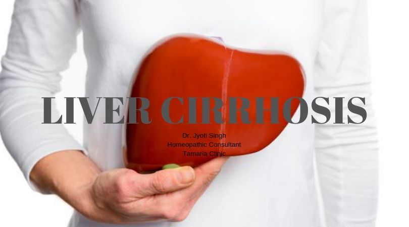 LIVER CIRRHOSIS