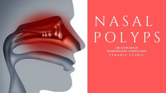 HOMEOPATHIC MANAGEMENT OF NASAL POLYPS!!