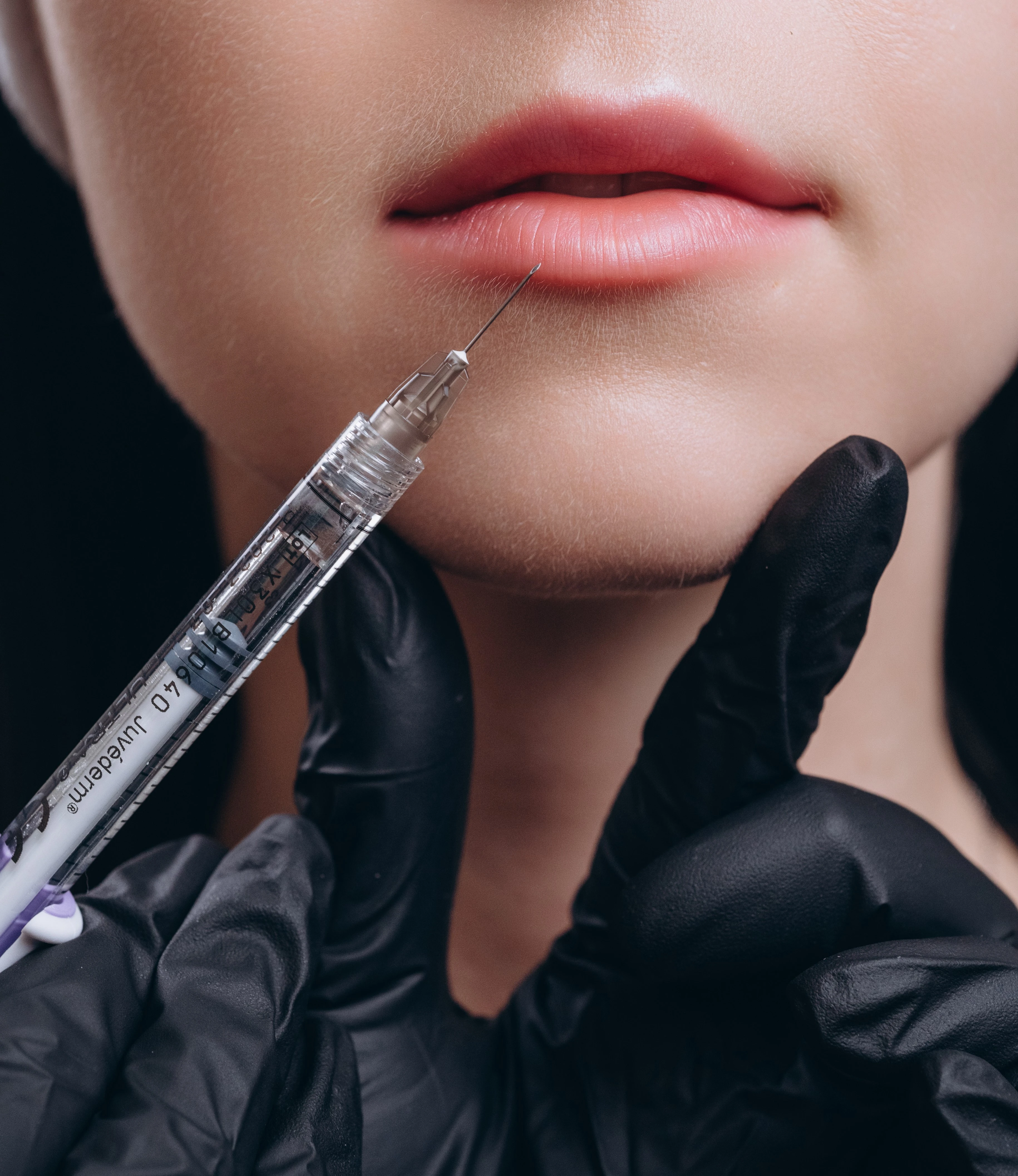 Контурна пластика губ