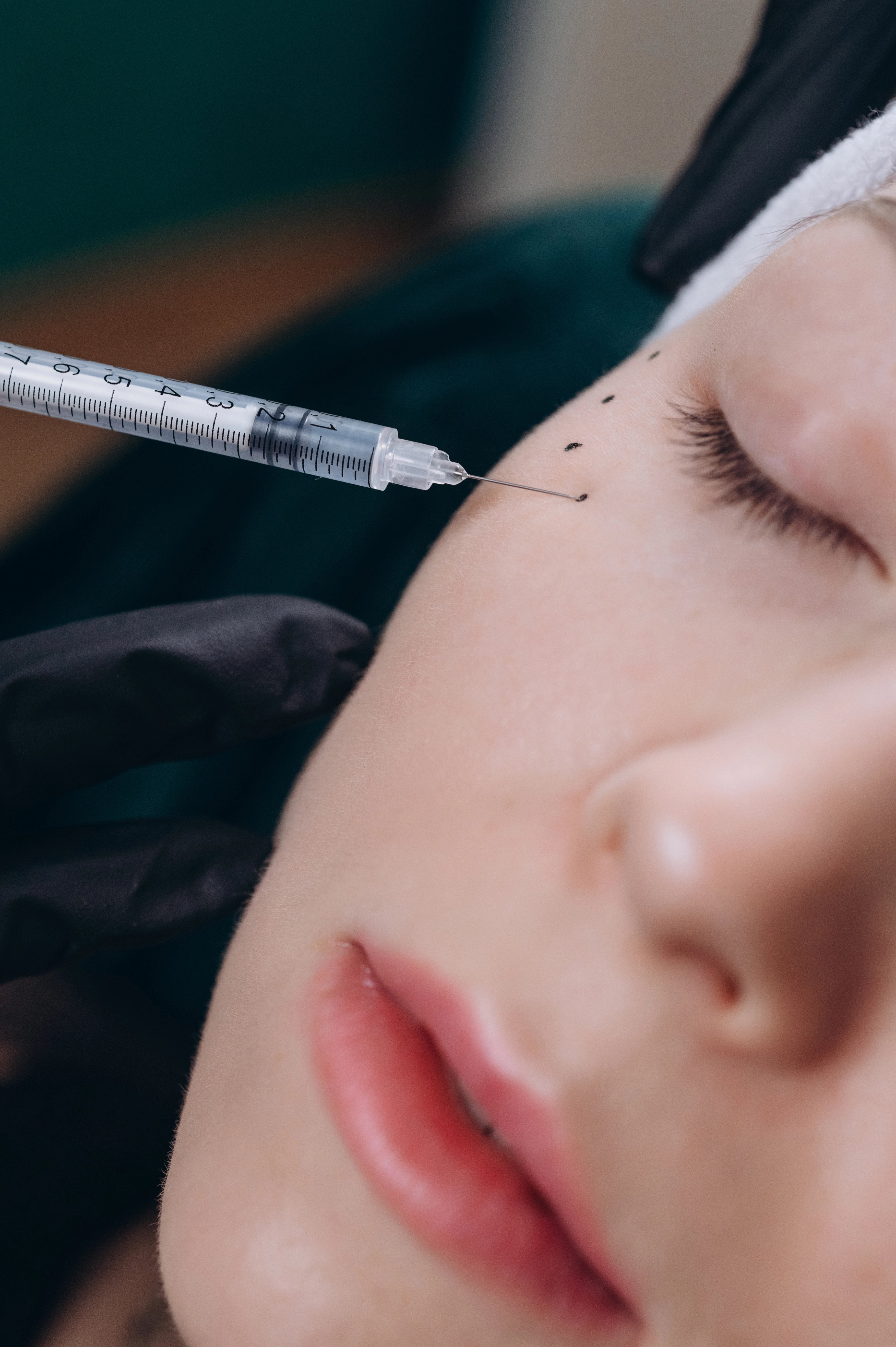 Мезотерапія