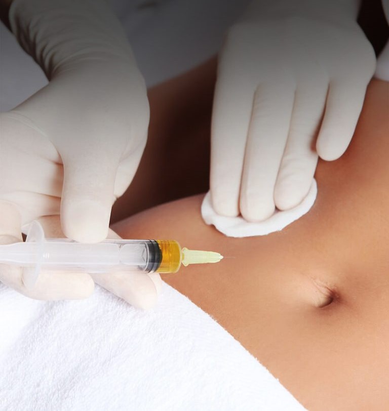 Ліполітики