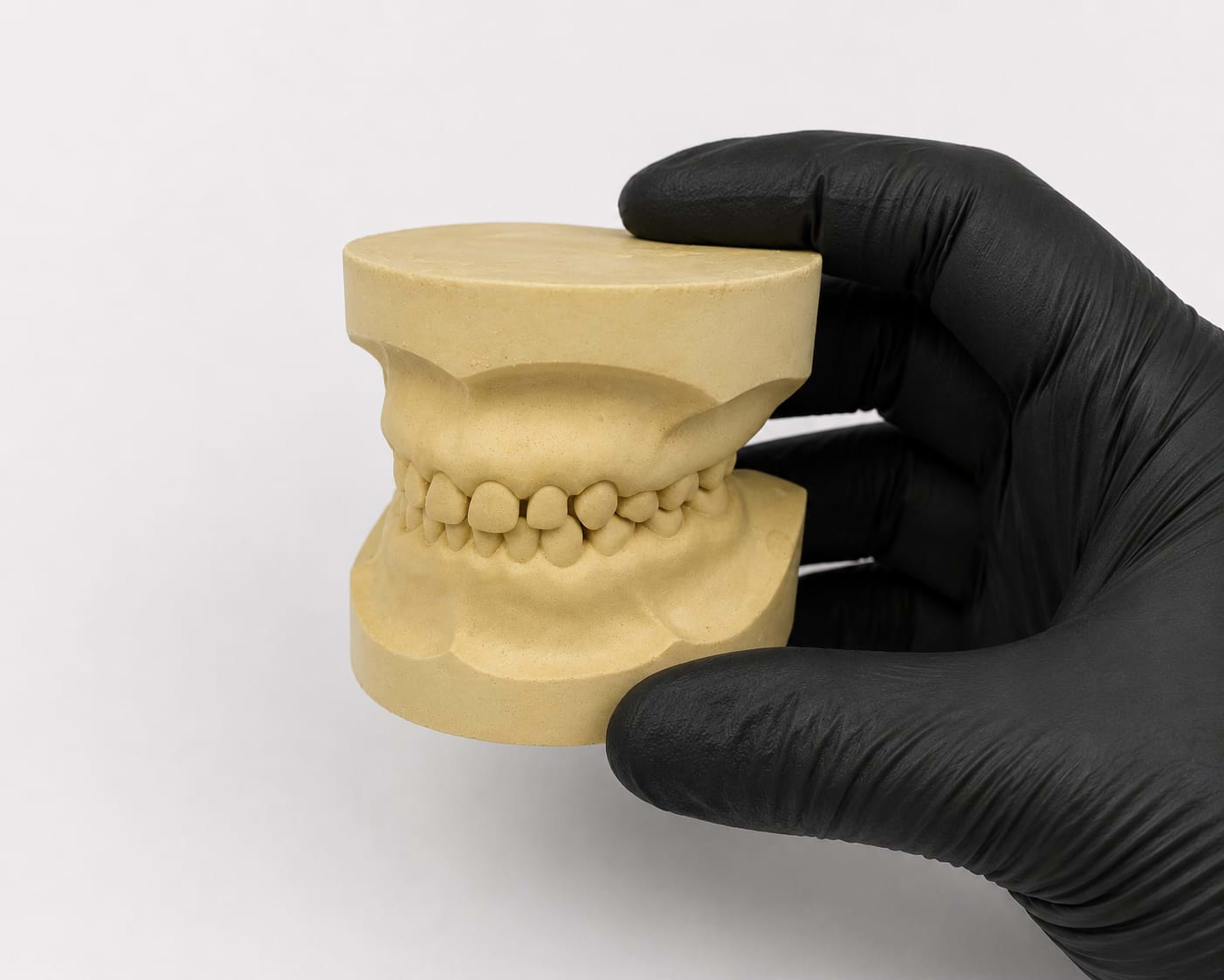 Pediatric stone cast