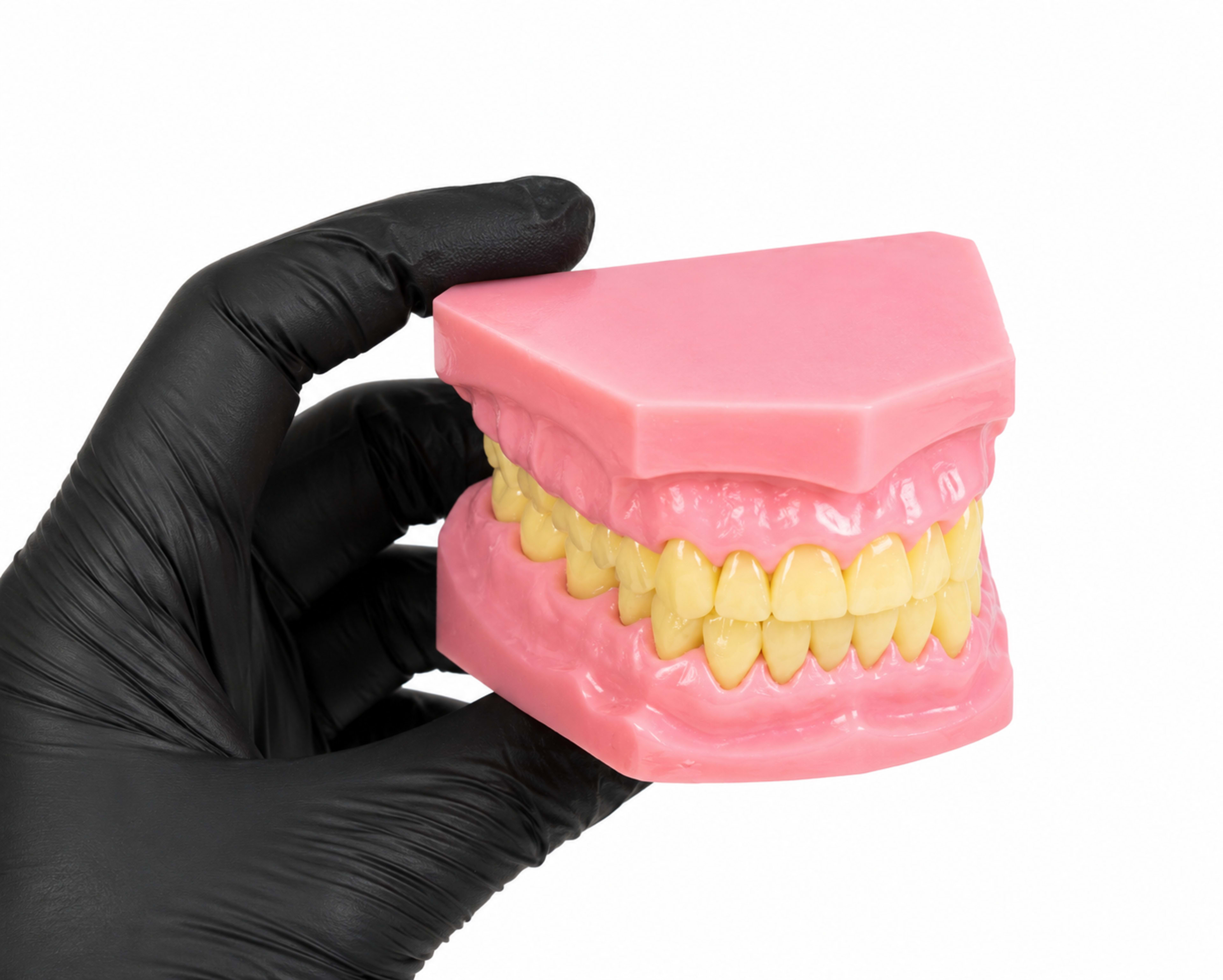 Ramsis Dental Cast - Image