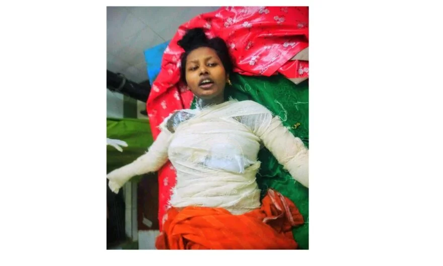 ফরিদগঞ্জে নিজের গায়ে কেরোসিন ঢেলে আগুন দিয়ে গৃহবধূর আত্মহত্যা চেষ্টা