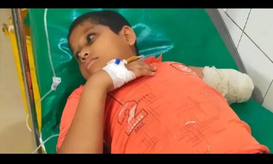 হাজীগঞ্জ সড়কে বিচ্ছিন্ন হাত রেখে হাসপাতালে চিকিৎসা নেয় কিশোর
